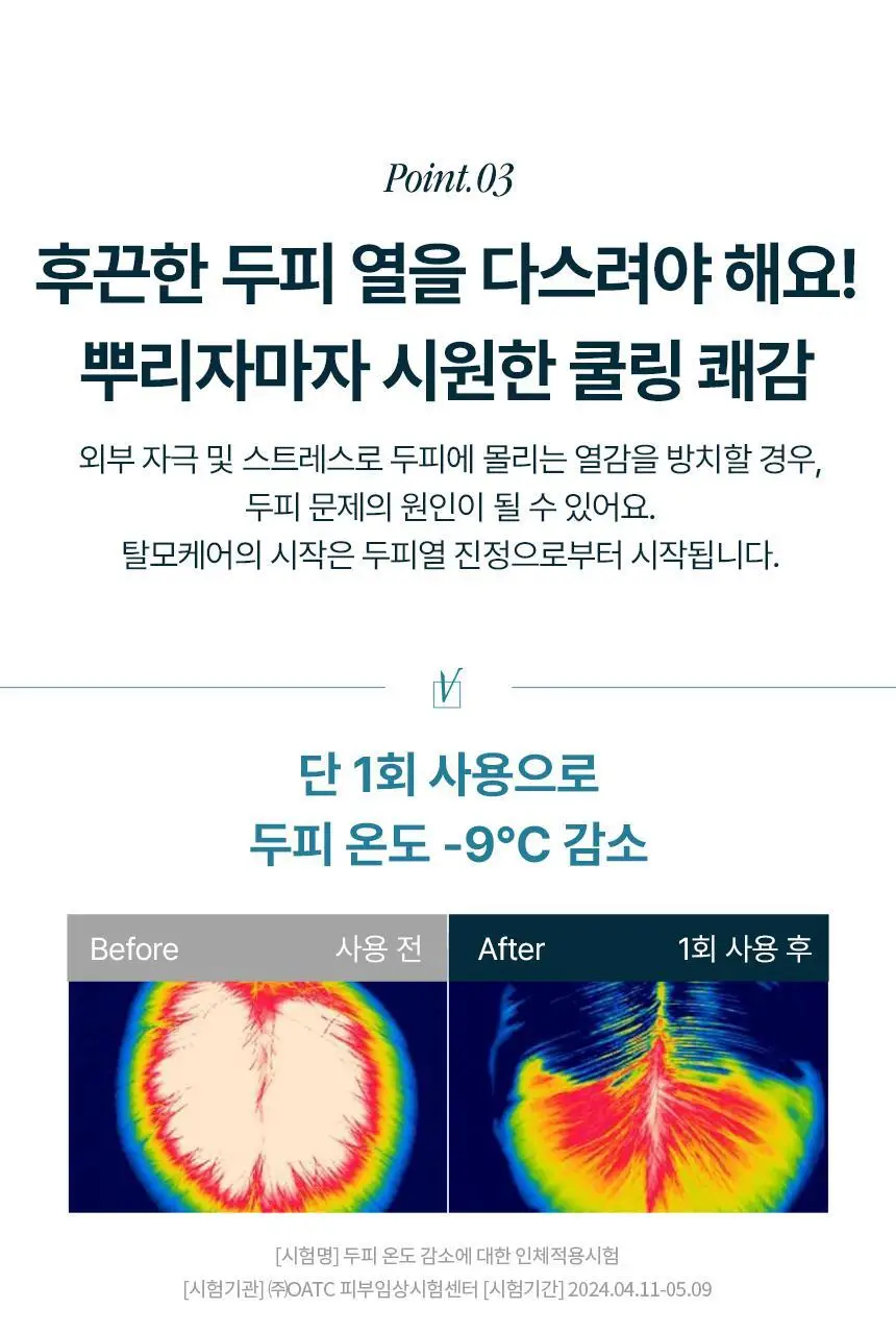 [탈모 전문가 토닉] 솔랩 탈모/민감두피 진정 미스트 토닉 100ml 상세페이지 19